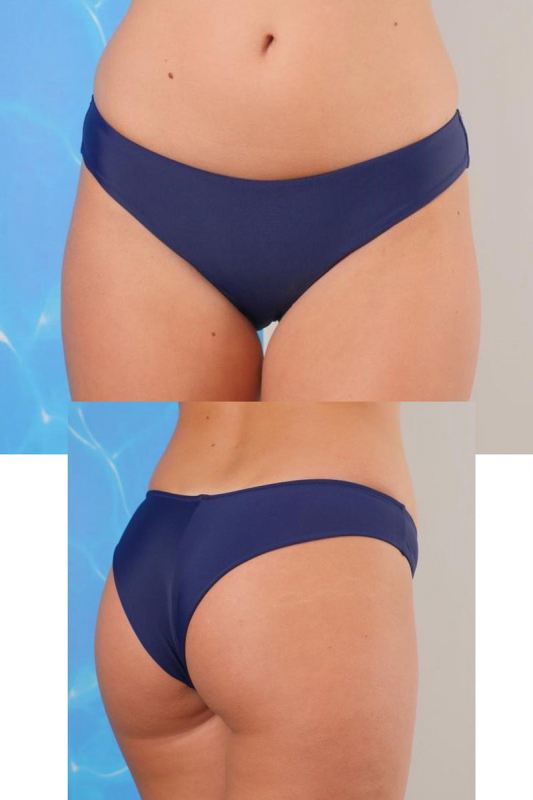 Купальні плавки бразиліана 81-169 Cosmo